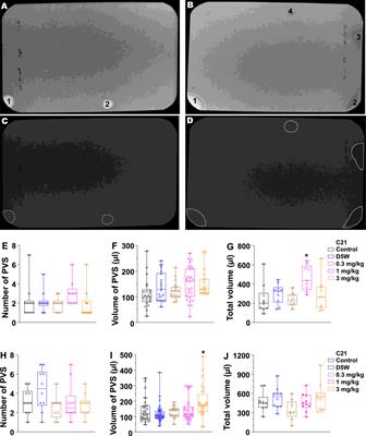 DREADD agonist compound 21 causes acute diuresis in wild-type mice